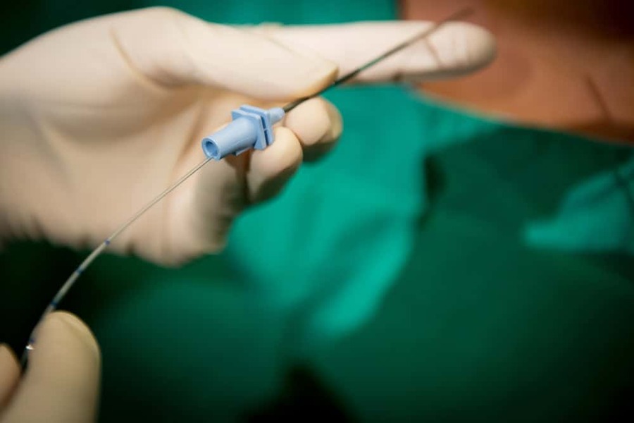 Epidural Philippines Manila