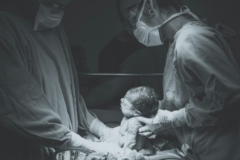 CS delivery birth Manila