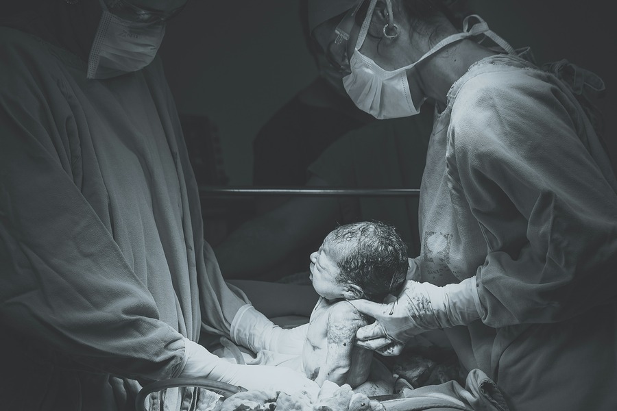 CS delivery birth Manila