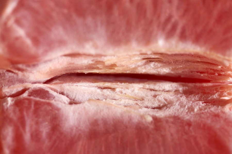 Vaginal rejuvenation Manila