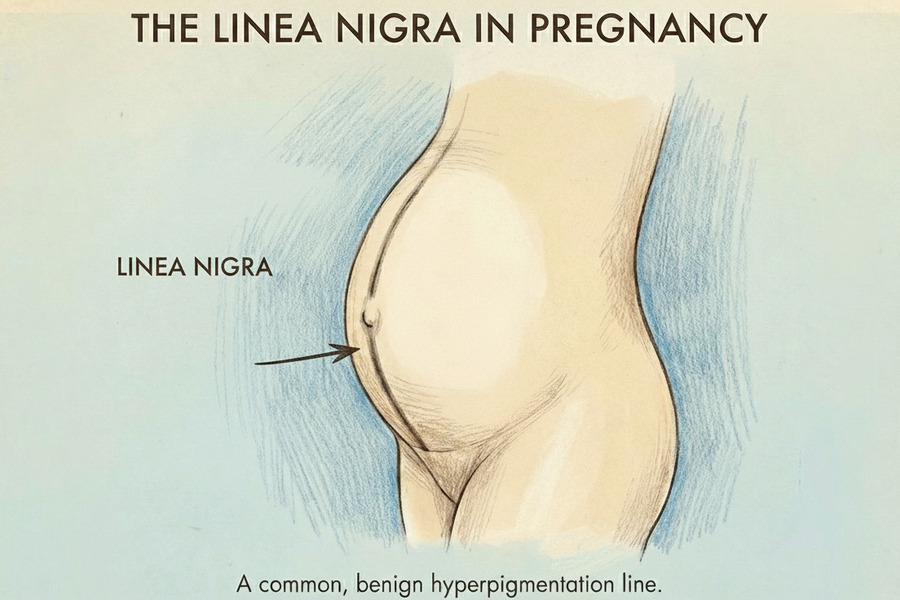 Linea Nigra dark line pregnancy