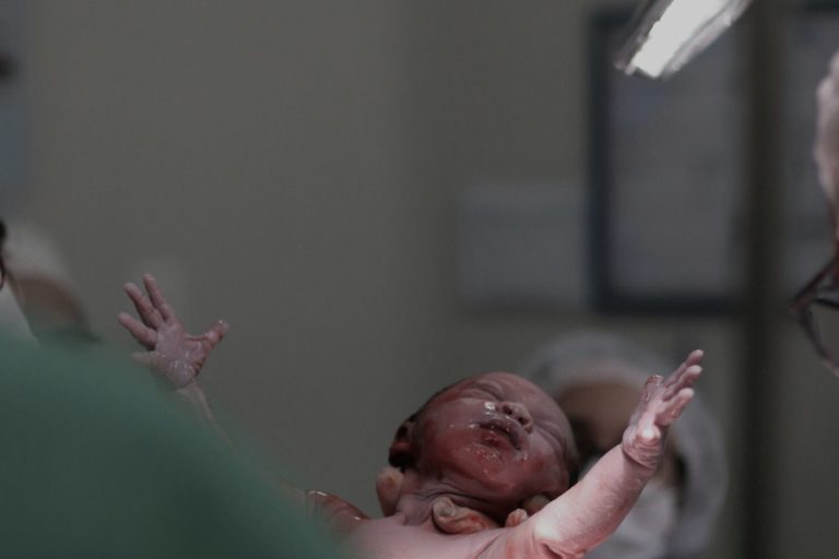 Vacuum Extraction Childbirth