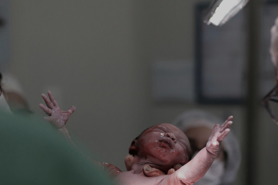 Vacuum Extraction Childbirth